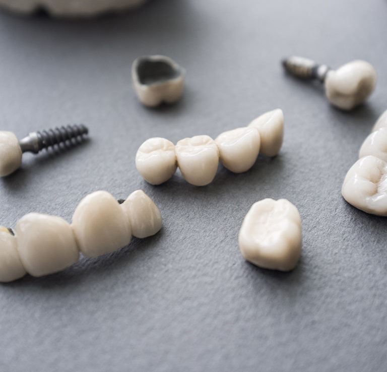 Dental crowns of various sizes